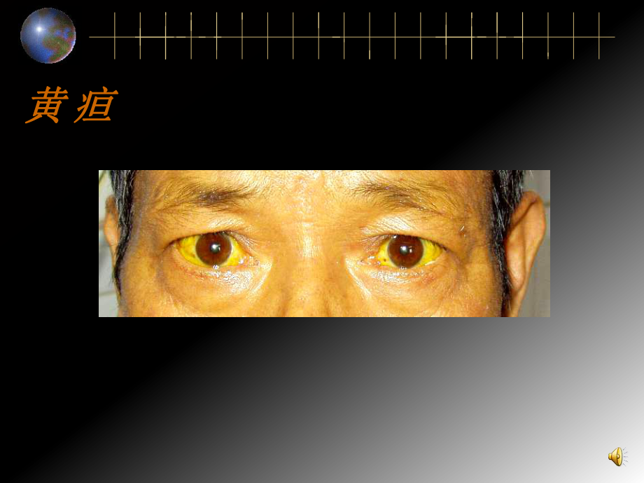 检体诊断学陈海燕症状学黄疸文档资料_第1页