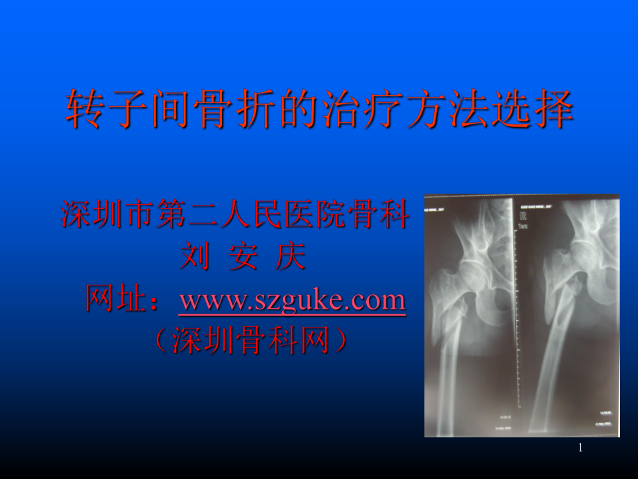 转子间骨折的治疗方法选择PPT课件_第1页