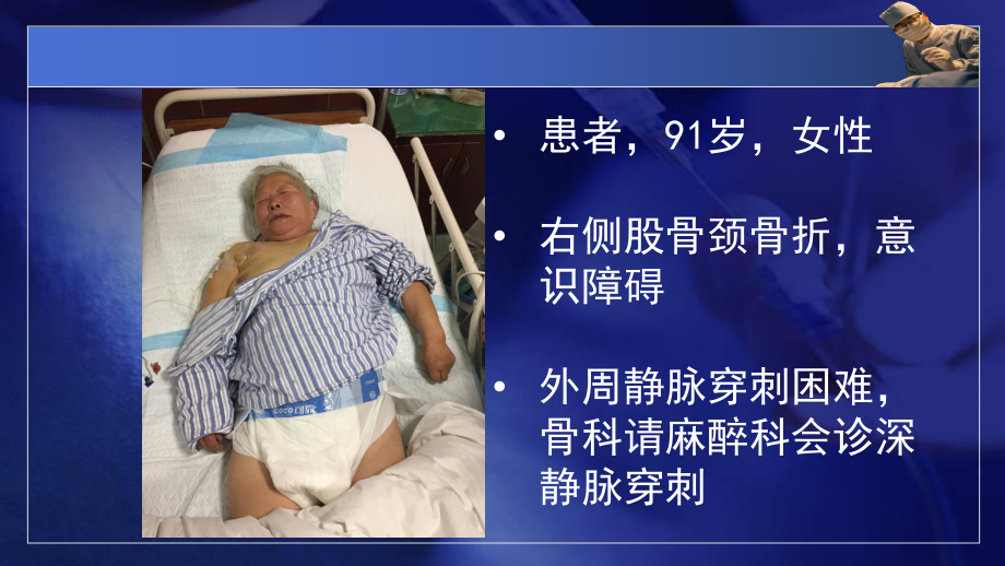 腋静脉穿刺置管ppt课件_第1页