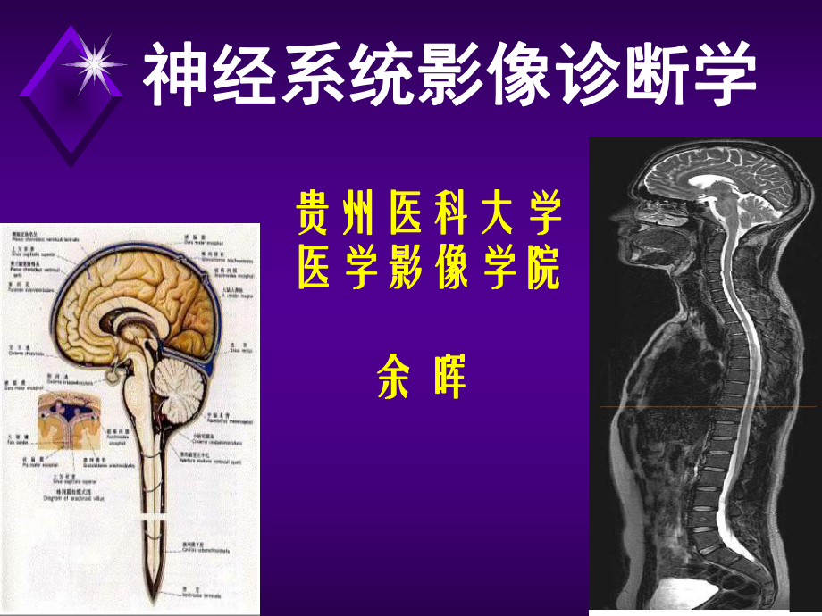 神经系统影像检查方法及临床应用_第1页
