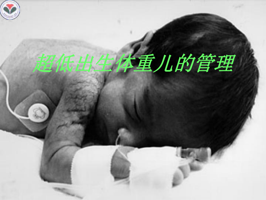 超低出生体重儿的管理09ppt课件_第1页