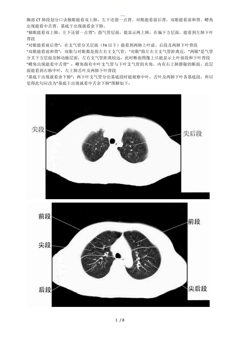 胸部CT肺段划分口诀_第1页