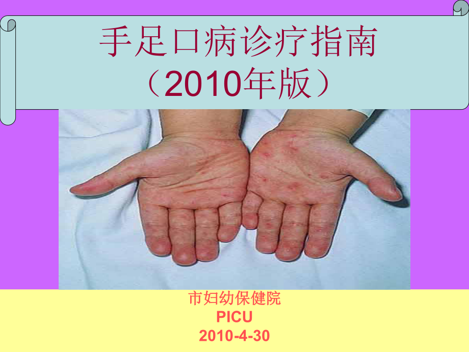 手足口病版解读参考PPT_第1页