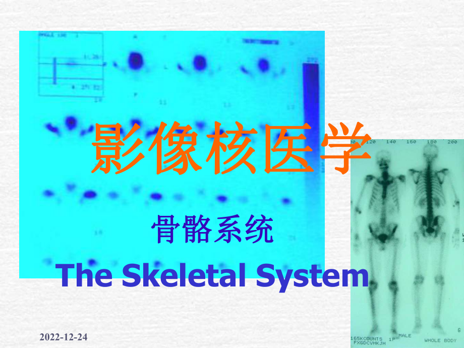《核医学骨骼系统》PPT课件_第1页