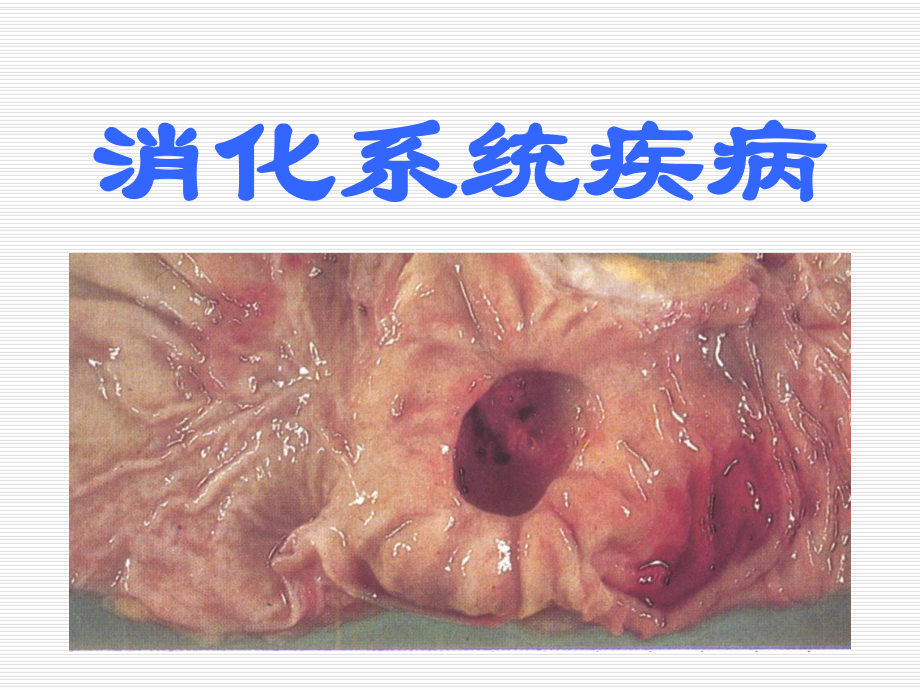 《慢性胃炎溃疡病》PPT课件_第1页